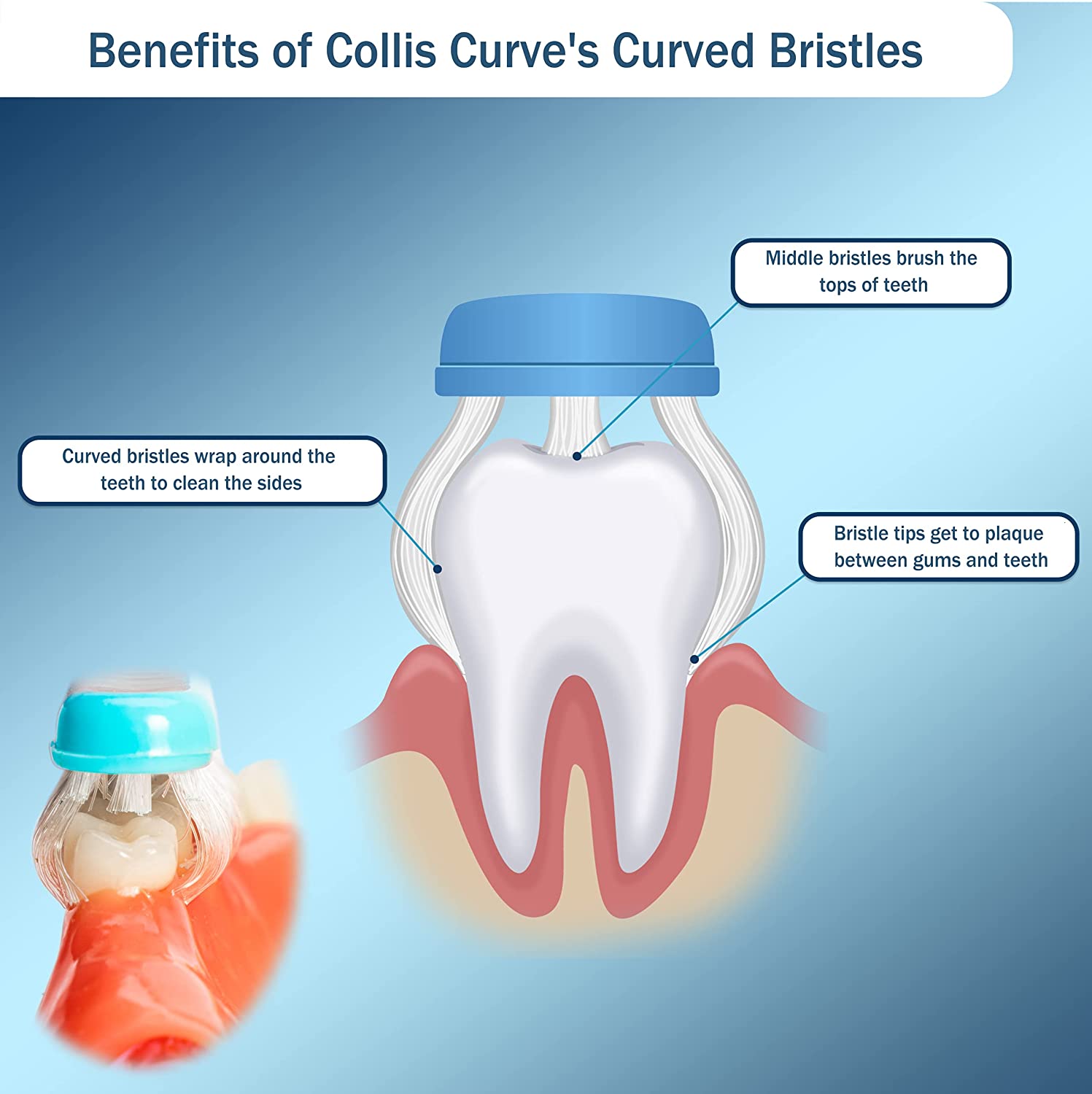 Benefits of Collis Curve soft toothbrush