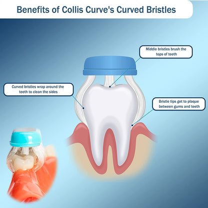 Collis-Curve periodontal toothbrush benefits